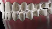 The 40 Million-Year-Old Ecosystem In Your Mouth