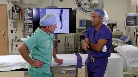 Video thumbnail: The Latest Procedure Endovascular Leg Therapies
