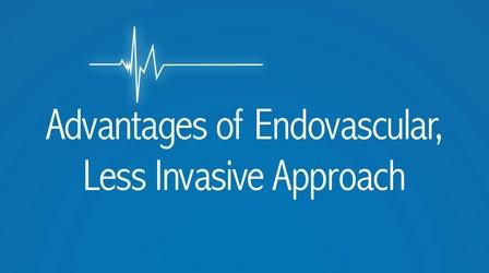 Video thumbnail: The Latest Procedure Advantages of The Less Invasive Endovascular Procedure