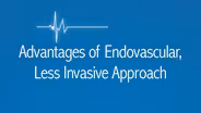 Advantages of The Less Invasive Endovascular Procedure