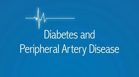 Video thumbnail: The Latest Procedure Diabetes and Peripheral Artery Disease