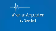 When an Amputation is Needed