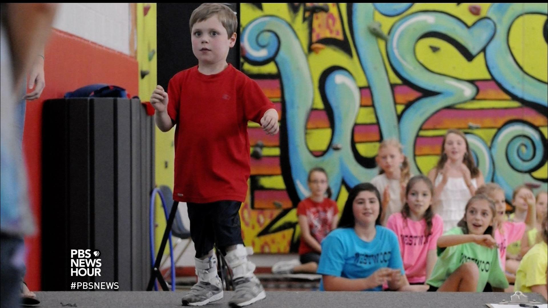 Kid ‘superman,’ born with heart defect, radiates strength