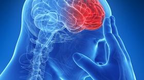 Video thumbnail: Health Matters: Television for Life Stroke: Causes, Symptoms and Treatment