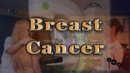 Breast Cancer