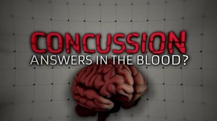 Video thumbnail: Concussion: Answers in the Blood? Concussion: Answers in the Blood?