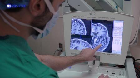 Video thumbnail: KVIE Digital Studios Deep Brain Stimulation | Focus on Health