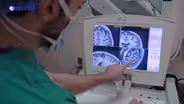 Deep Brain Stimulation | Focus on Health