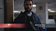 American Skin