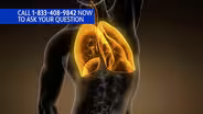 Lung Cancer on the Rise - Preview