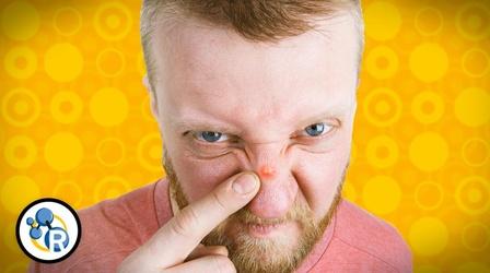 Video thumbnail: Reactions What's the Deal with Acne?