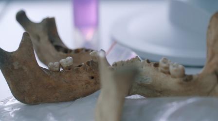 Tooth Samples Reveal Scope of Justinianic Plague