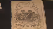 The Original Siamese Twins