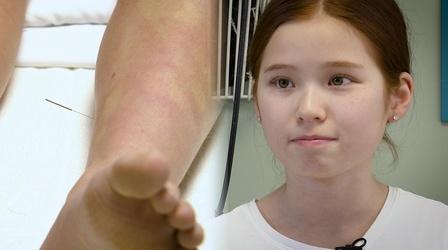 Video thumbnail: KVIE Digital Studios Pediatric Acupuncture | Focus on Health