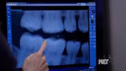 Children's Dental Health Month