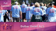 Bulbar Onset ALS