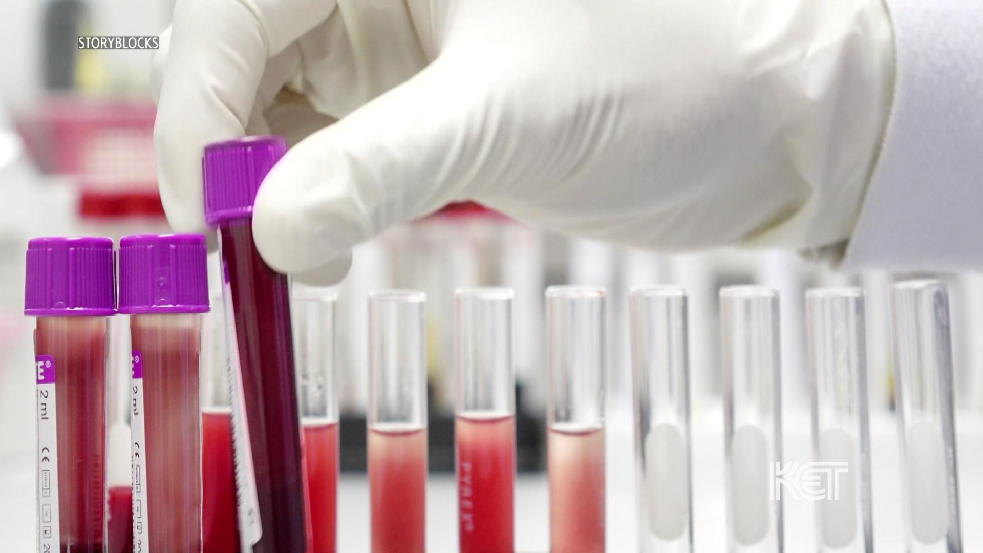 New Study Shows Accuracy of Alzheimer's Blood Test