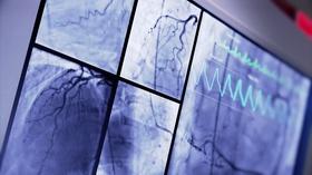Video thumbnail: Health Matters: Television for Life Heart Health FEB 21