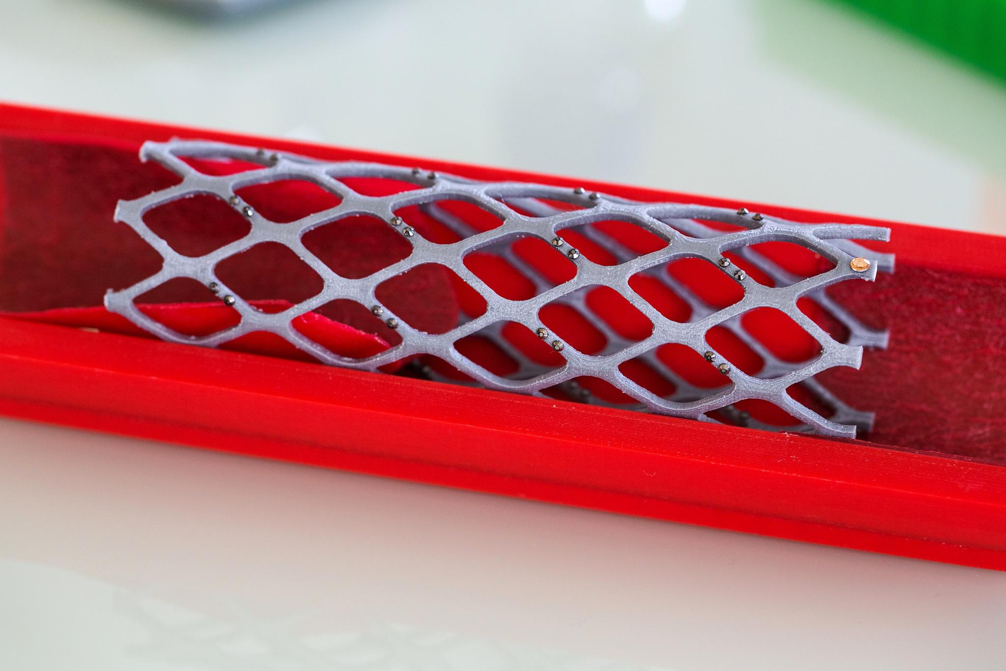 Study questions whether stents relieve chest pain
