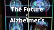 The Battle Against Alzheimer's