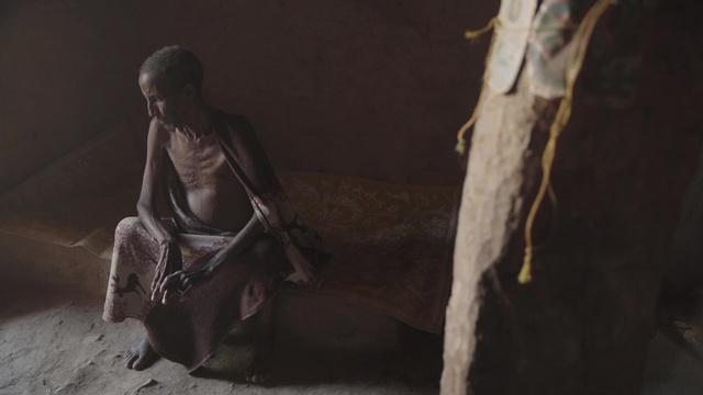 Ethiopia conflict eases, but starvation risk remains