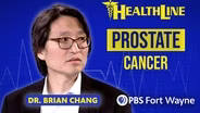 Prostate Cancer: PSA Screening, Diagnosis & Treatment