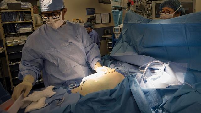 Improving the U.S. transplant process