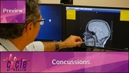 Concussions