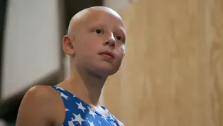Bald and Bold