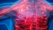 Vascular Disease - Preview