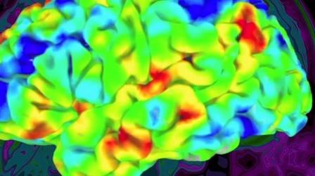 Video thumbnail: SciTech Now Alzheimer's May Be More Complicated