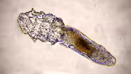 These Face Mites Really Grow on You