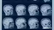 Your Brain On Science Preview