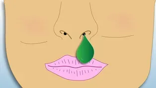 Snot 101