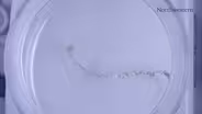 Pain Relief Implant: A Look at New Scientific Breakthroughs