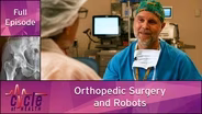 Orthopedic Surgery and Robots
