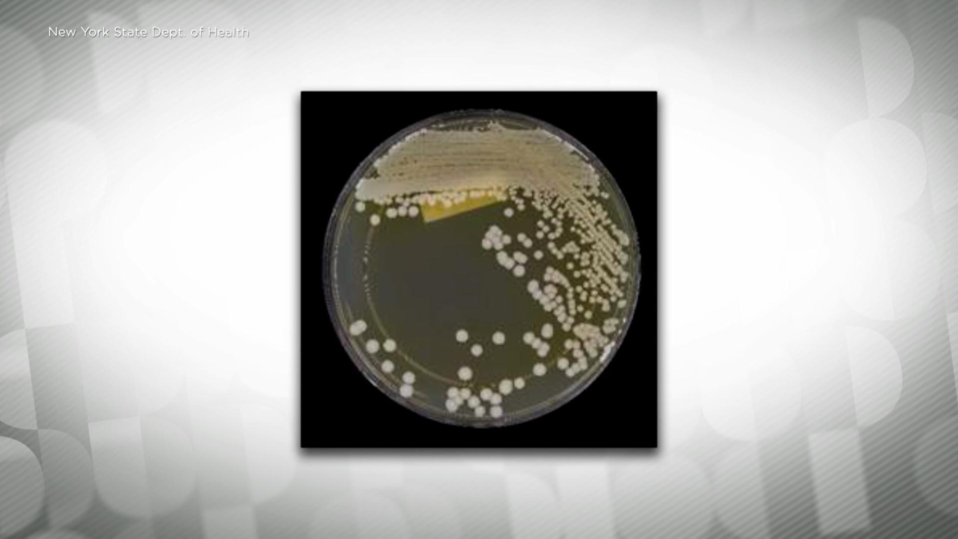 Warning of threat from C. auris a drug resistant fungus