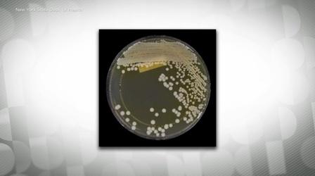 Warning of threat from C. auris, a drug-resistant fungus