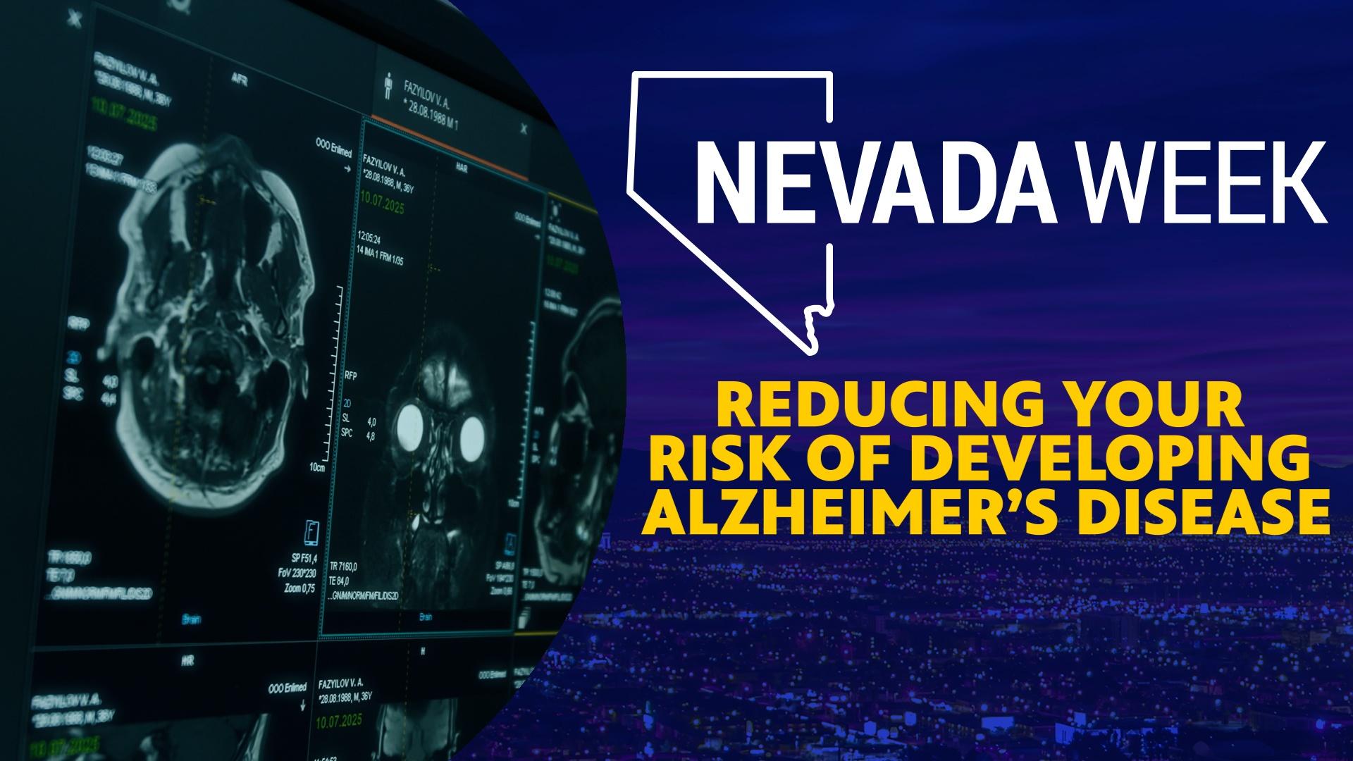We talk to UNLV Department of Brain Health’s Dr. Jeffrey Cummings.