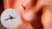 Why Mosquitoes Buzz in Your Ear
