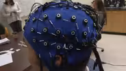 Breakthrough in Alzheimer's Disease