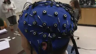 Breakthrough in Alzheimer's Disease