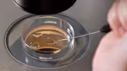 Frozen Embryos; Ukrainian Women