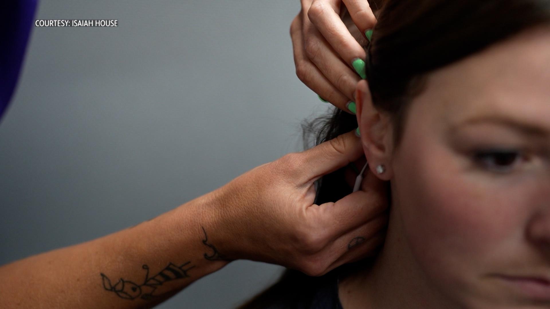 New Device Approved to Treat Opioid Addiction