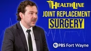 Joint Replacement Surgery Explained