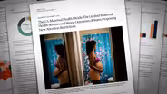 Higher maternal health risks in states that ban abortion