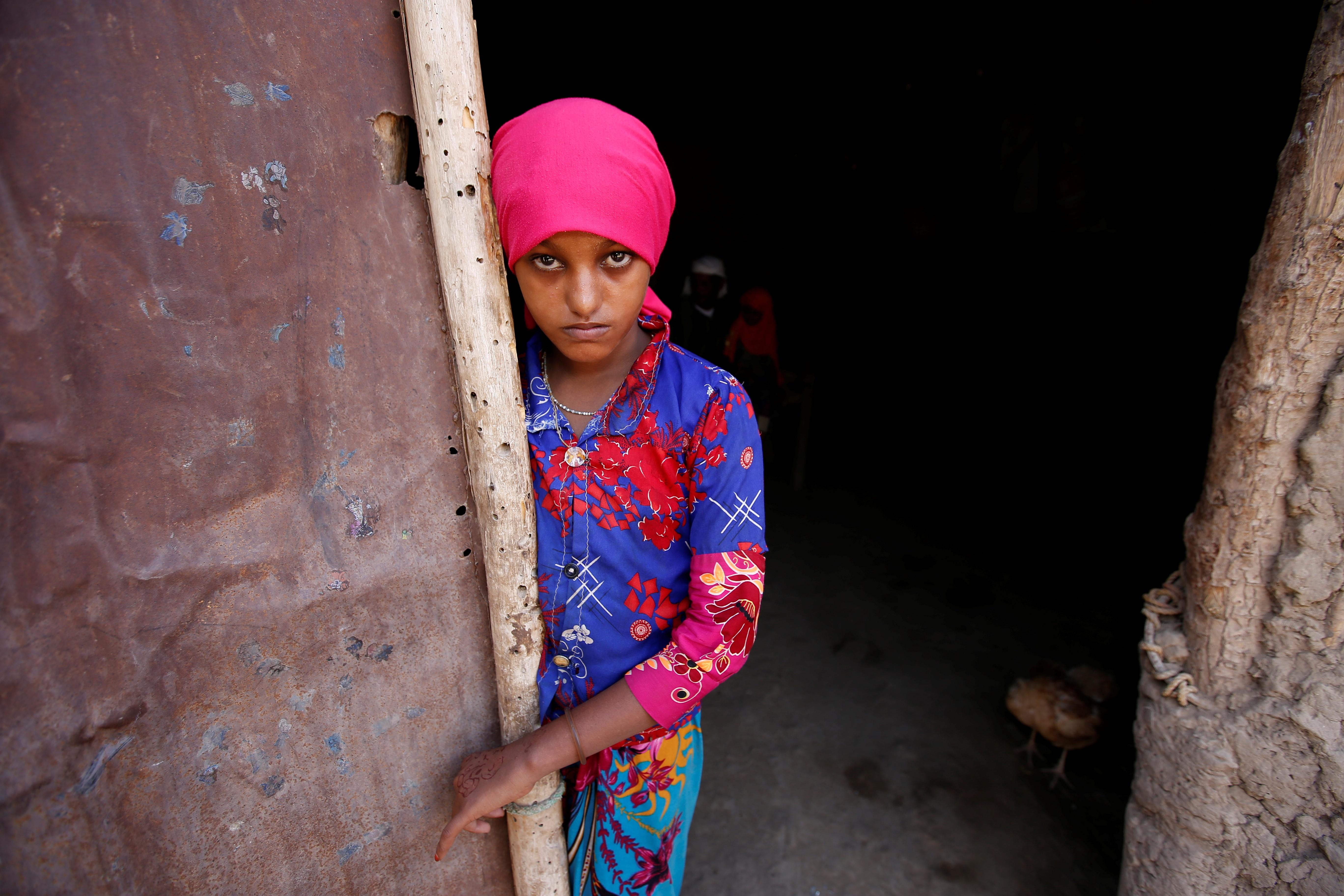 Yemen ravaged by cholera and war, what role does U.S. play?