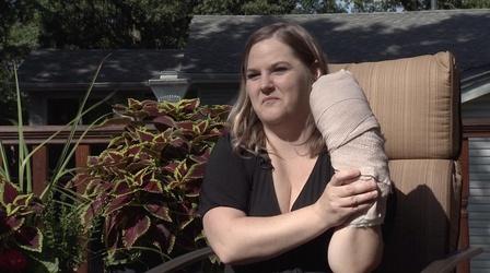 Video thumbnail: Almanac Rep. Erin Koegel’s Recent Accident
