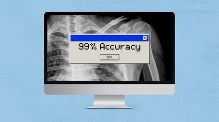 Video thumbnail: Vitals Why A.I. Won’t Replace Doctors