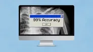 Why A.I. Won’t Replace Doctors